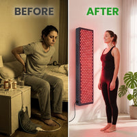 Red Light Therapy Panel Device – Full Body Panel, 630Nm 660Nm 810Nm 850Nm Red & near Infrared Light Therapy, 300 Quad Chip Leds, Brightness Control, Pulse Mode – ULTRA1500 — Before & After